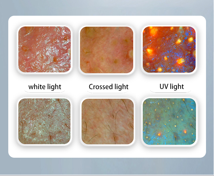 AI Skin Analyzer price